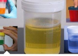 Često mokrite manje količine urina? Noću se budite da idete u wc? Ovo su simptomi jednog sindroma! Evo šta je u pitanju Često mokrite manje količine urina? Noću se budite da idete u wc? Ovo su simptomi jednog sindroma! Evo šta je u pitanju - featured image