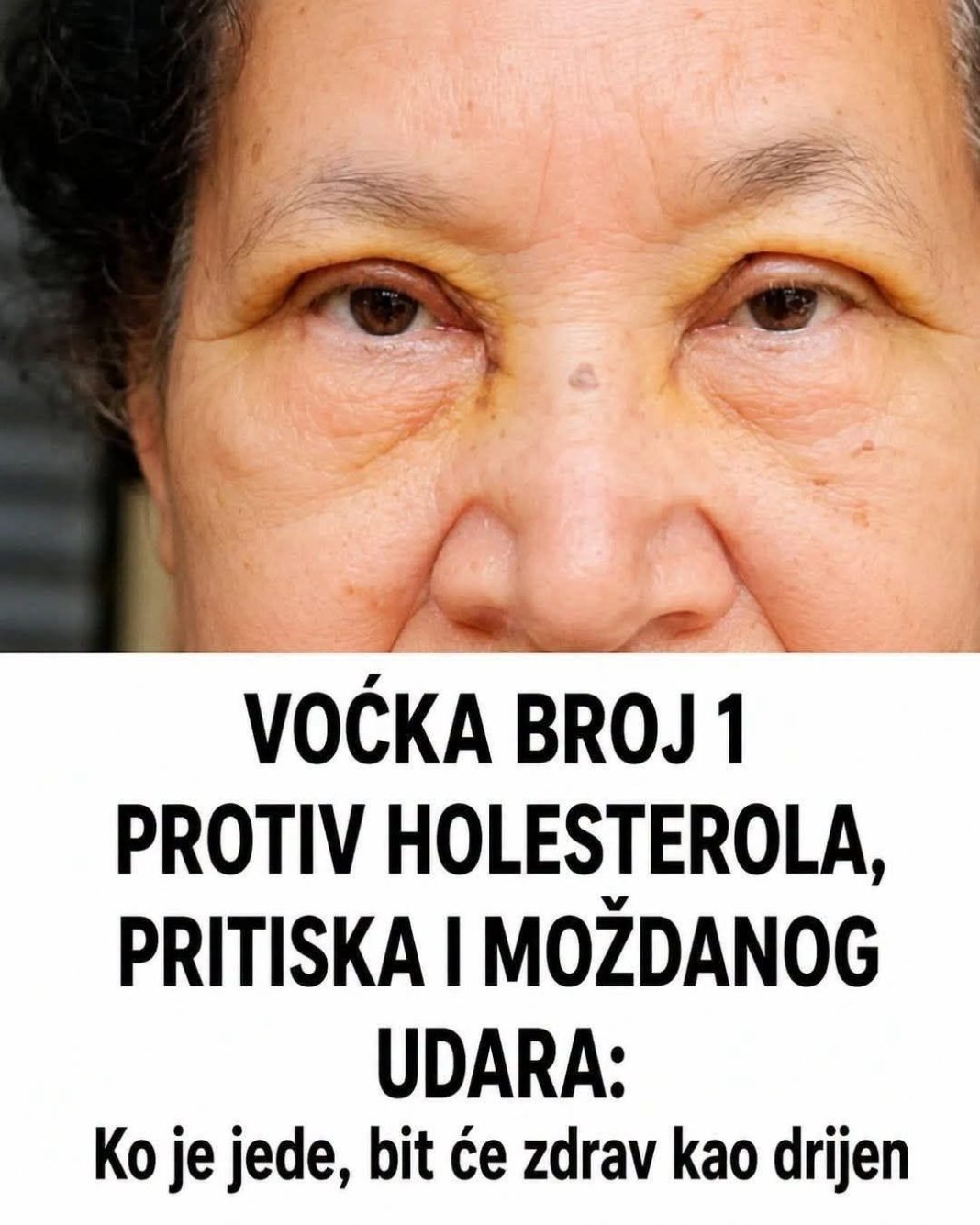 VOĆKA BROJ 1 PROTIV HOLESTEROLA, PRITISKA I MOŽDANOG UDARA: Ko je jede, bit će zdrav kao drijen - featured image