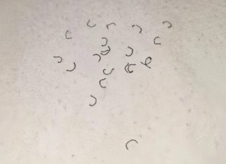 Zašto se na čaršavima pojavljuju vlakna i odakle ona dolaze? Zašto se na čaršavima pojavljuju vlakna i odakle ona dolaze? - featured image