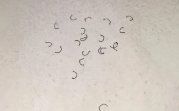 Zašto se na čaršavima pojavljuju vlakna i odakle ona dolaze? Zašto se na čaršavima pojavljuju vlakna i odakle ona dolaze? - featured image