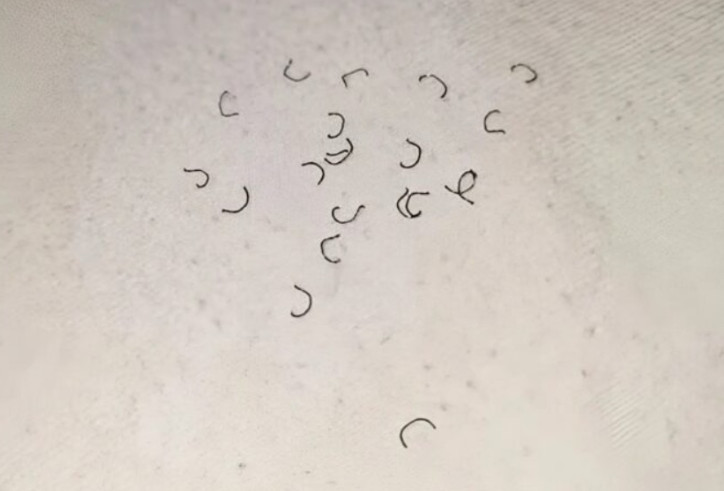 Zašto se na čaršavima pojavljuju vlakna i odakle ona dolaze? - featured image