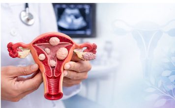 Žene obratite pažnju: Ovo su prvi simptomi mioma materice, obično ih je više, a ovi su najčešći Žene obratite pažnju: Ovo su prvi simptomi mioma materice, obično ih je više, a ovi su najčešći - featured image