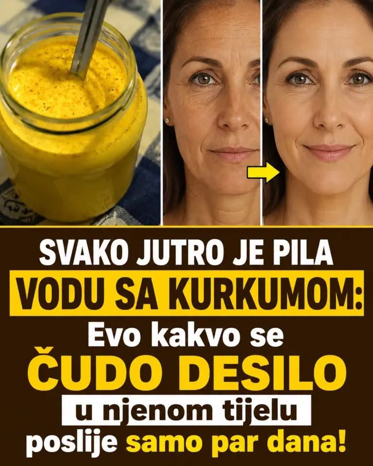 SVAKO JUTRO JE PILA VODU SA KURKUMOM: Evo kakvo se čudo desilo u njenom tijelu poslije samo par dana - featured image