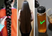 SPREČITE OPADANJE KOSE: Uz ovaj preparat kosa će rasti gušća i jača nego ikada SPREČITE OPADANJE KOSE: Uz ovaj preparat kosa će rasti gušća i jača nego ikada - featured image