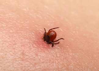 Bezbolno je i nema čupanja: Doktorka otkrila trik kako da se krpelj sam otkači sa kože (video) Bezbolno je i nema čupanja: Doktorka otkrila trik kako da se krpelj sam otkači sa kože (video) - featured image