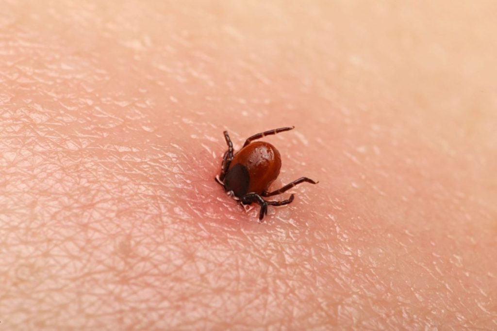 Bezbolno je i nema čupanja: Doktorka otkrila trik kako da se krpelj sam otkači sa kože (video) - featured image Bezbolno je i nema čupanja: Doktorka otkrila trik kako da se krpelj sam otkači sa kože (video) - featured image
