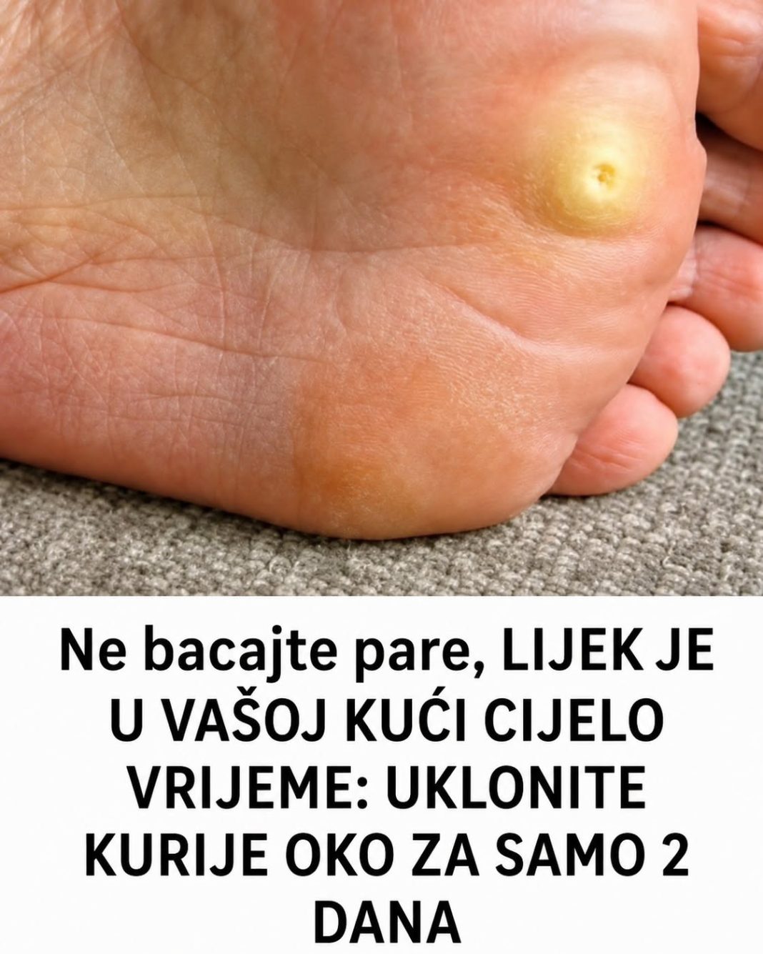 Ne bacajte pare, LIJEK JE U VAŠOJ KUĆI CIJELO VRIJEME: UKLONITE KURIJE OKO ZA SAMO 2 DANA - featured image