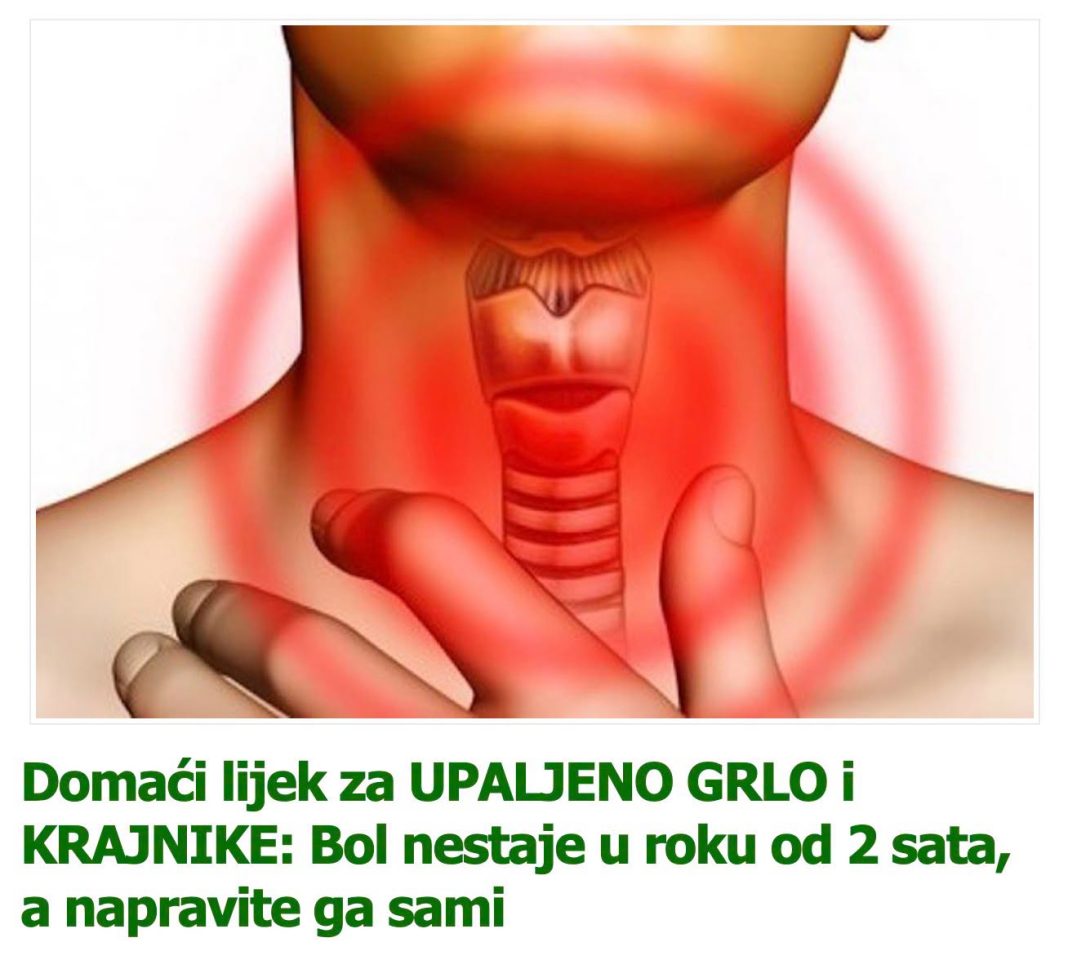 Domaći lijek za UPALJENO GRLO i KRAJNIKE: Bol nestaje u roku od 2 sata, a napravite ga sami - featured image Domaći lijek za UPALJENO GRLO i KRAJNIKE: Bol nestaje u roku od 2 sata, a napravite ga sami - featured image