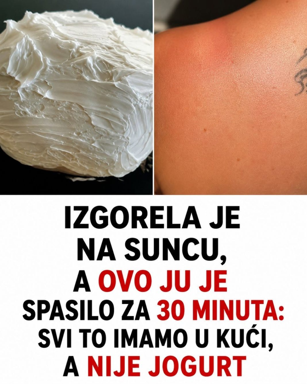 Izgorela je na suncu, a ovo ju je spasilo za 30 minuta: Svi to imamo u kući, a nije jogurt - featured image Izgorela je na suncu, a ovo ju je spasilo za 30 minuta: Svi to imamo u kući, a nije jogurt - featured image