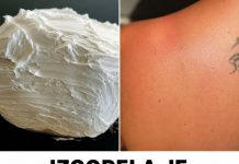 Izgorela je na suncu, a ovo ju je spasilo za 30 minuta: Svi to imamo u kući, a nije jogurt Izgorela je na suncu, a ovo ju je spasilo za 30 minuta: Svi to imamo u kući, a nije jogurt - featured image