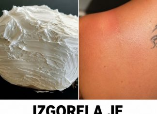 Izgorela je na suncu, a ovo ju je spasilo za 30 minuta: Svi to imamo u kući, a nije jogurt Izgorela je na suncu, a ovo ju je spasilo za 30 minuta: Svi to imamo u kući, a nije jogurt - featured image