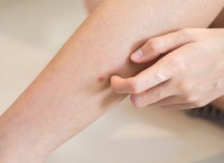 What Itching in Different Parts of Your Body Could Mean — and When You Should See a Doctor